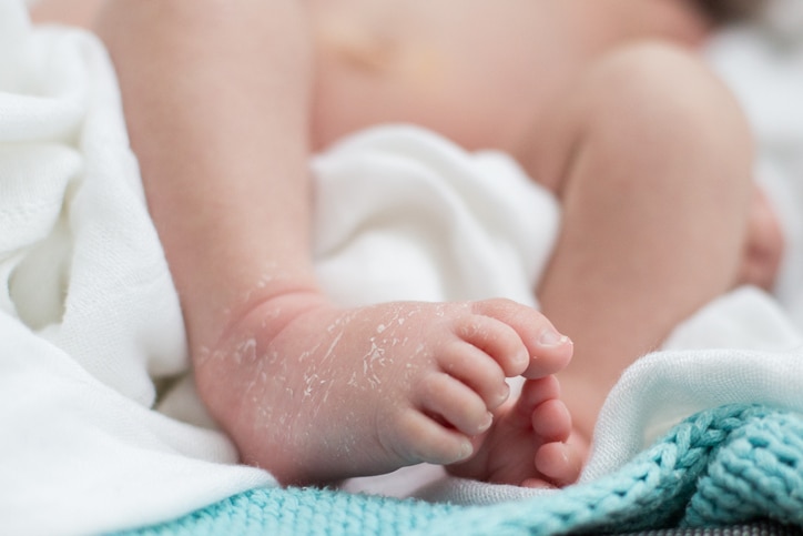 Dry skin newborn baby feet on white and blue background