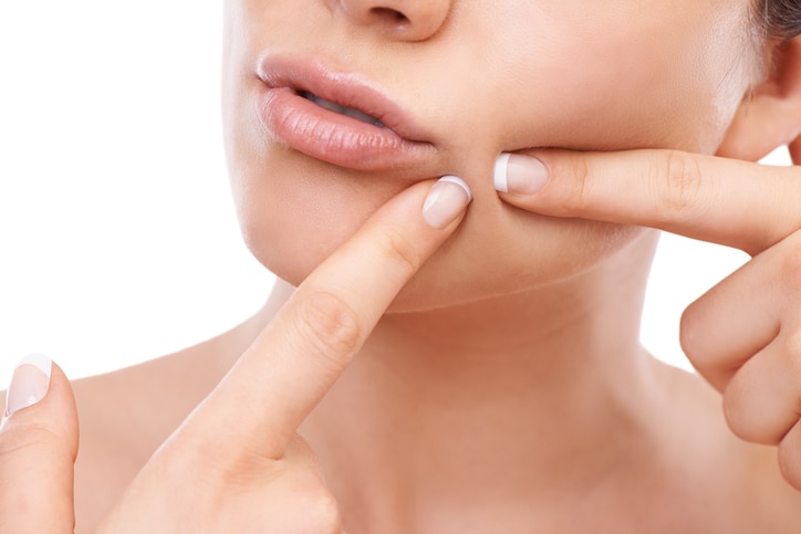 A cropped image of a woman squeezing a pimple