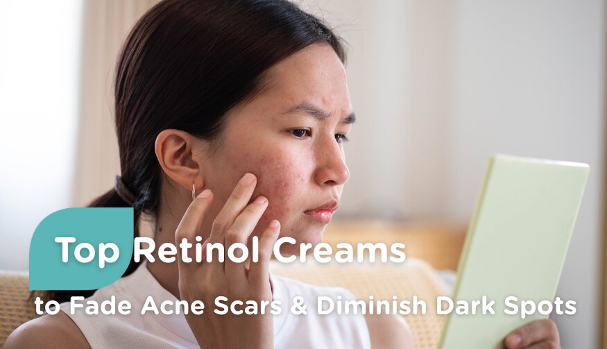 Top Retinol Creams To Fade Acne Scars Diminish Dark Spots Skincare Top Retinol Creams To Fade Acne Scars Diminish Dark Spots Skincare