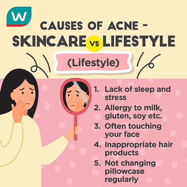 How the modern daily life and pollutions cause acne